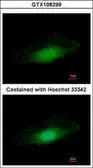 Anti-PPP4C antibody [N1], N-term used in Immunocytochemistry/ Immunofluorescence (ICC/IF). GTX108299