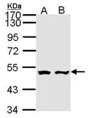Anti-AKD1 antibody [N1], N-term used in Western Blot (WB). GTX108308