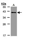 Anti-KLHDC8A antibody [C2C3], C-term used in Western Blot (WB). GTX108361