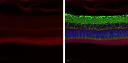 Anti-ABCA4 antibody [C3-2], C-term used in IHC (Paraffin sections) (IHC-P). GTX108371
