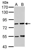 Anti-RED antibody [N1], N-term used in Western Blot (WB). GTX108398
