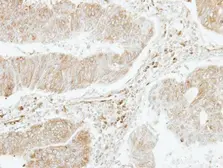 Anti-PF4V1 antibody [N3C3] used in IHC (Paraffin sections) (IHC-P). GTX108457