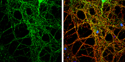 Anti-PACSIN1 antibody used in Immunocytochemistry/ Immunofluorescence (ICC/IF). GTX108567