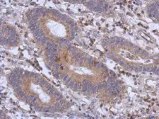 Anti-RFX6 antibody [C2C3], C-term used in IHC (Paraffin sections) (IHC-P). GTX108670