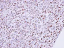 Anti-MIPP antibody [N2C3] used in IHC (Paraffin sections) (IHC-P). GTX108680