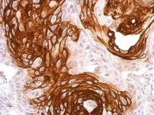 Anti-Activin Receptor Type IA antibody used in IHC (Paraffin sections) (IHC-P). GTX108827