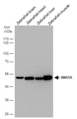 Anti-SMAD5 antibody used in Western Blot (WB). GTX108917