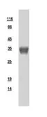 Human PPP6C protein, His tag. GTX108968-pro