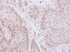 Anti-TFIIE beta antibody used in IHC (Paraffin sections) (IHC-P). GTX109005