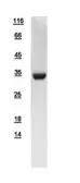 Human HMGCL protein, His tag. GTX109096-pro