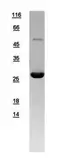 Human RALB protein, His tag. GTX109101-pro