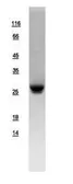 Human NNT1 protein, His tag. GTX109107-pro