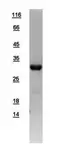 Human BCL10 protein, His tag. GTX109159-pro