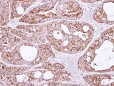 Anti-SAR1B antibody used in IHC (Paraffin sections) (IHC-P). GTX109170