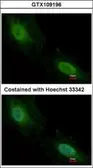 Anti-Aprataxin antibody used in Immunocytochemistry/ Immunofluorescence (ICC/IF). GTX109196