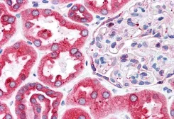 Anti-BCAP31 antibody, C-term used in IHC (Paraffin sections) (IHC-P). GTX10924