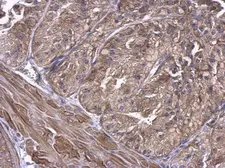 Anti-UBE2D1 antibody used in IHC (Paraffin sections) (IHC-P). GTX109257