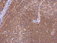 Anti-Telethonin antibody [N1C3] used in IHC (Paraffin sections) (IHC-P). GTX109265
