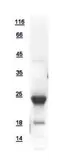Human SelS protein, His tag. GTX109311-pro