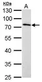 Anti-MMP16 antibody used in Western Blot (WB). GTX109378