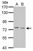 Anti-GRHL2 antibody used in Western Blot (WB). GTX109410