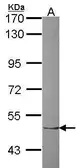 Anti-ZNF212 antibody [N1C1] used in Western Blot (WB). GTX109506