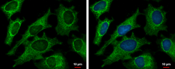 Anti-DECR1 antibody [N1C3] used in Immunocytochemistry/ Immunofluorescence (ICC/IF). GTX109608