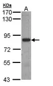 Anti-3BP2 antibody used in Western Blot (WB). GTX109708