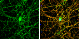 Anti-NMDAR2B antibody [C2C3], C-term used in Immunocytochemistry/ Immunofluorescence (ICC/IF). GTX109713