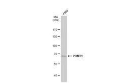 Anti-POMT1 antibody [C1C3] used in Western Blot (WB). GTX109717