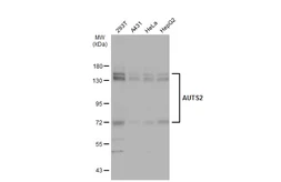 Anti-AUTS2 antibody [N3C1], Internal used in Western Blot (WB). GTX109811