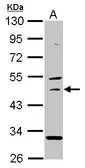 Anti-USH1G antibody [N2C2], Internal used in Western Blot (WB). GTX109975