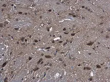 Anti-CYP2R1 antibody [N1C2] used in IHC (Paraffin sections) (IHC-P). GTX110050