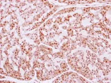 Anti-FANCE antibody [N3C3] used in IHC (Paraffin sections) (IHC-P). GTX110184