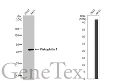 Anti-Plakophilin 1 antibody [N2C1], Internal used in Western Blot (WB). GTX110201