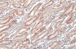 Anti-ENaC Alpha antibody [N3C2], Internal used in IHC (Paraffin sections) (IHC-P). GTX110436