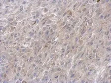 Anti-VPS33B antibody [N3C2], Internal used in IHC (Paraffin sections) (IHC-P). GTX110467