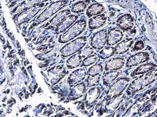 Anti-PIASy antibody used in IHC (Paraffin sections) (IHC-P). GTX110497