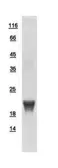 Human GADD45A protein, His tag. GTX110705-pro