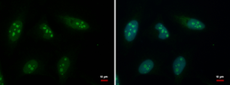 Anti-GTPBP4 antibody used in Immunocytochemistry/ Immunofluorescence (ICC/IF). GTX110825