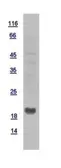 Human NDUFB6 protein, His tag. GTX110979-pro