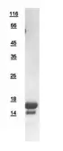 Human FIS1 protein, His tag. GTX111010-pro