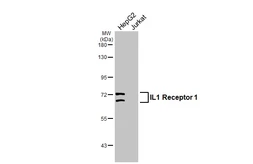 Anti-IL1 Receptor 1 antibody [C1C3] used in Western Blot (WB). GTX111092