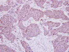 Anti-MEK5 antibody [N1N3] used in IHC (Paraffin sections) (IHC-P). GTX111129