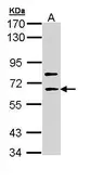 Anti-SHC4 antibody [C1C3] used in Western Blot (WB). GTX111256