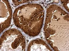 Anti-BTG1 antibody used in IHC (Paraffin sections) (IHC-P). GTX111321