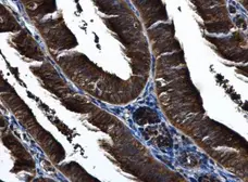 Anti-IKK epsilon antibody [C2C3], C-term used in IHC (Paraffin sections) (IHC-P). GTX111350