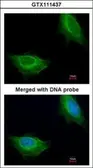 Anti-ADCK1 antibody [N1N3] used in Immunocytochemistry/ Immunofluorescence (ICC/IF). GTX111437