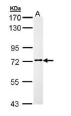 Anti-FASTKD3 antibody [C1C3-2] used in Western Blot (WB). GTX111480