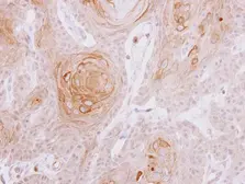 Anti-MYLK2 antibody [N3C3-2] used in IHC (Paraffin sections) (IHC-P). GTX111514